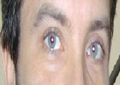 italianskorpios